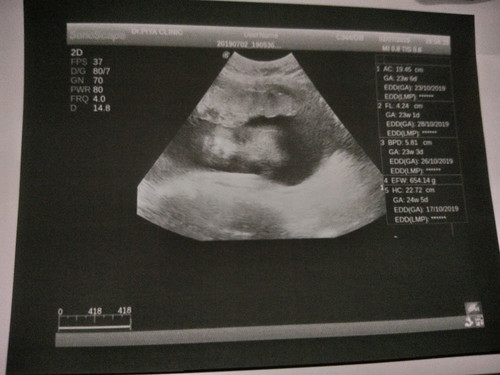 บ้านใหนคลอดเดือนตุลาบ้างค่ะ
