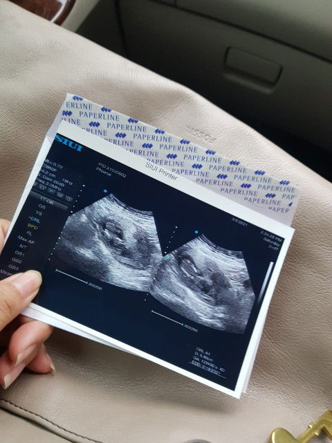 calonbuna profile icon