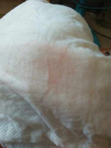 สีฉี่ของน้อง