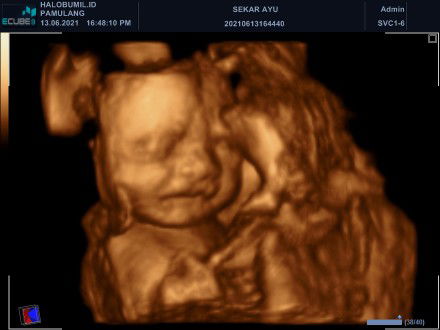 Sekar Ayu Astari profile icon