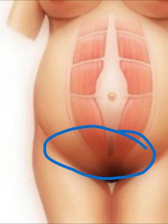 ปวดหัวหน่าวหรือป่าว