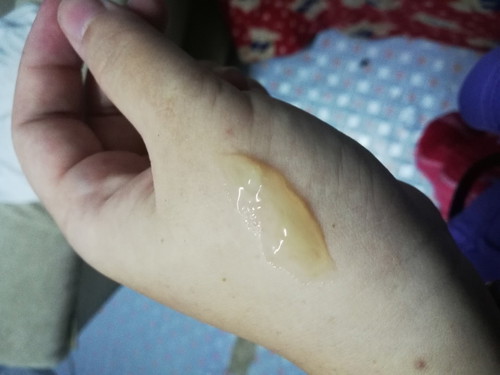 มูกหรือตกขาว