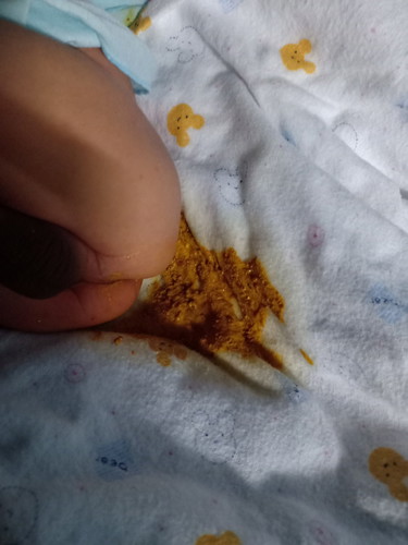 ถ่ายท้อง