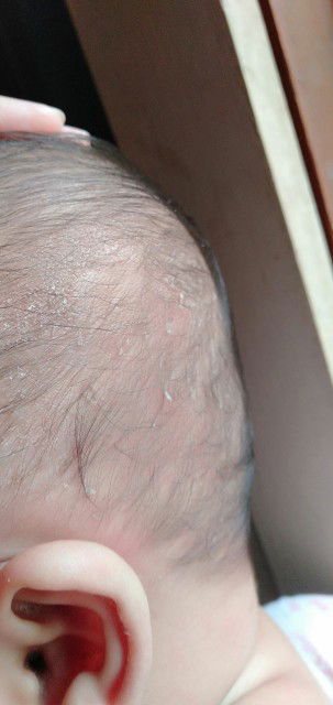 yang jijik jangan dibuka!!