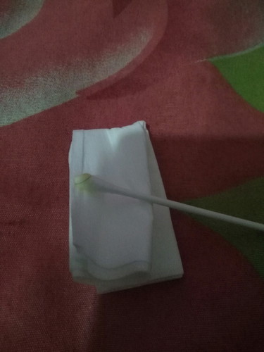 keluar cairan dari telinga