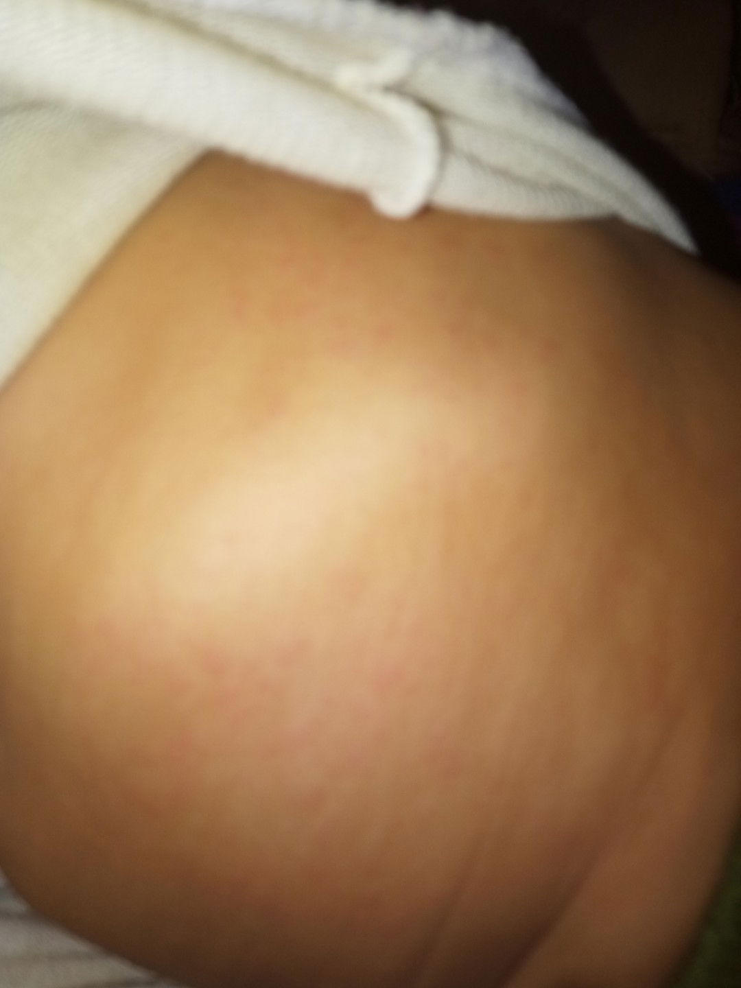 bintik merah di area badan