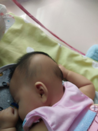 ตอนนี้ลูกได้2เดือน26วัน หัวน้องเริ่มแบนนิดหน่อยแม่ๆๆบ้านไหนมีวิธีแนะนำมั้ยค่ะ