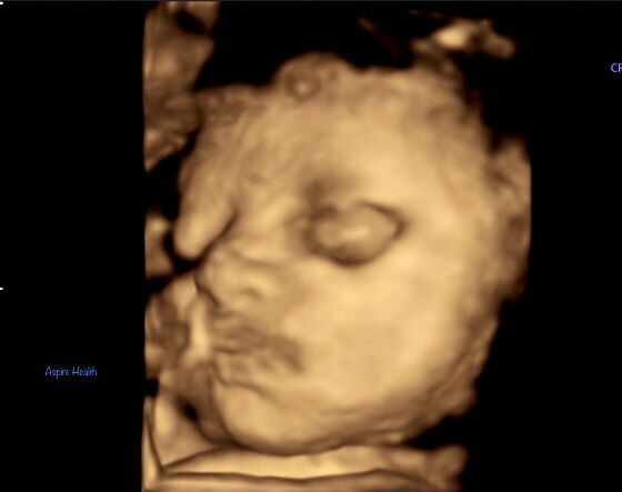 Jornalyn Bensurto profile icon