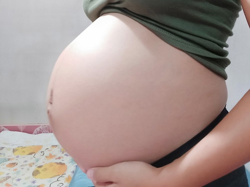39 week หมอนัด 21 ส.ค.
