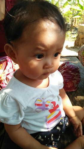 Rambut nya rontok