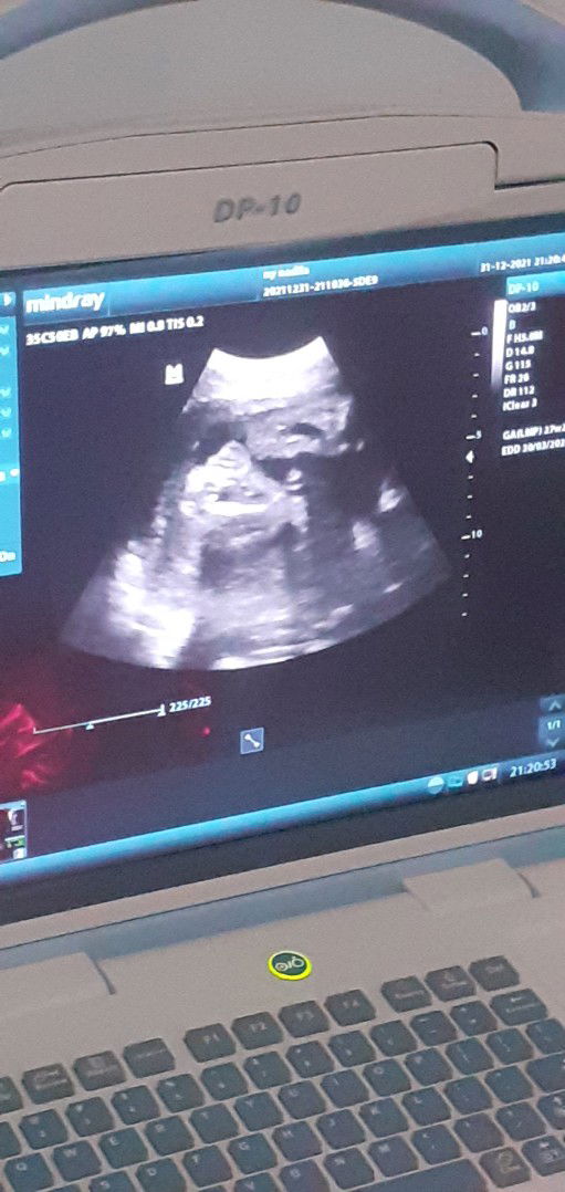 Nadila Susanti profile icon