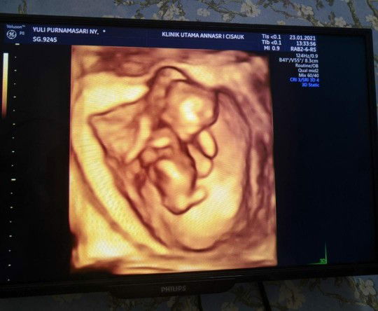 Yuli Purnama sari profile icon