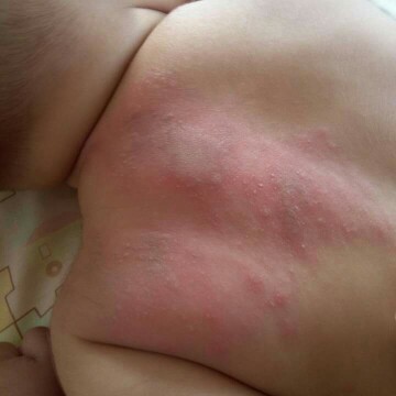 มาแชร์ประสบการณ์