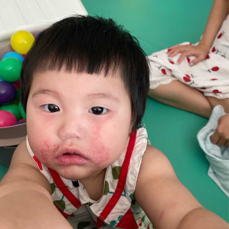 ลูกแพ้อะไรไม่รู้ หาหมอไม่หายสักที