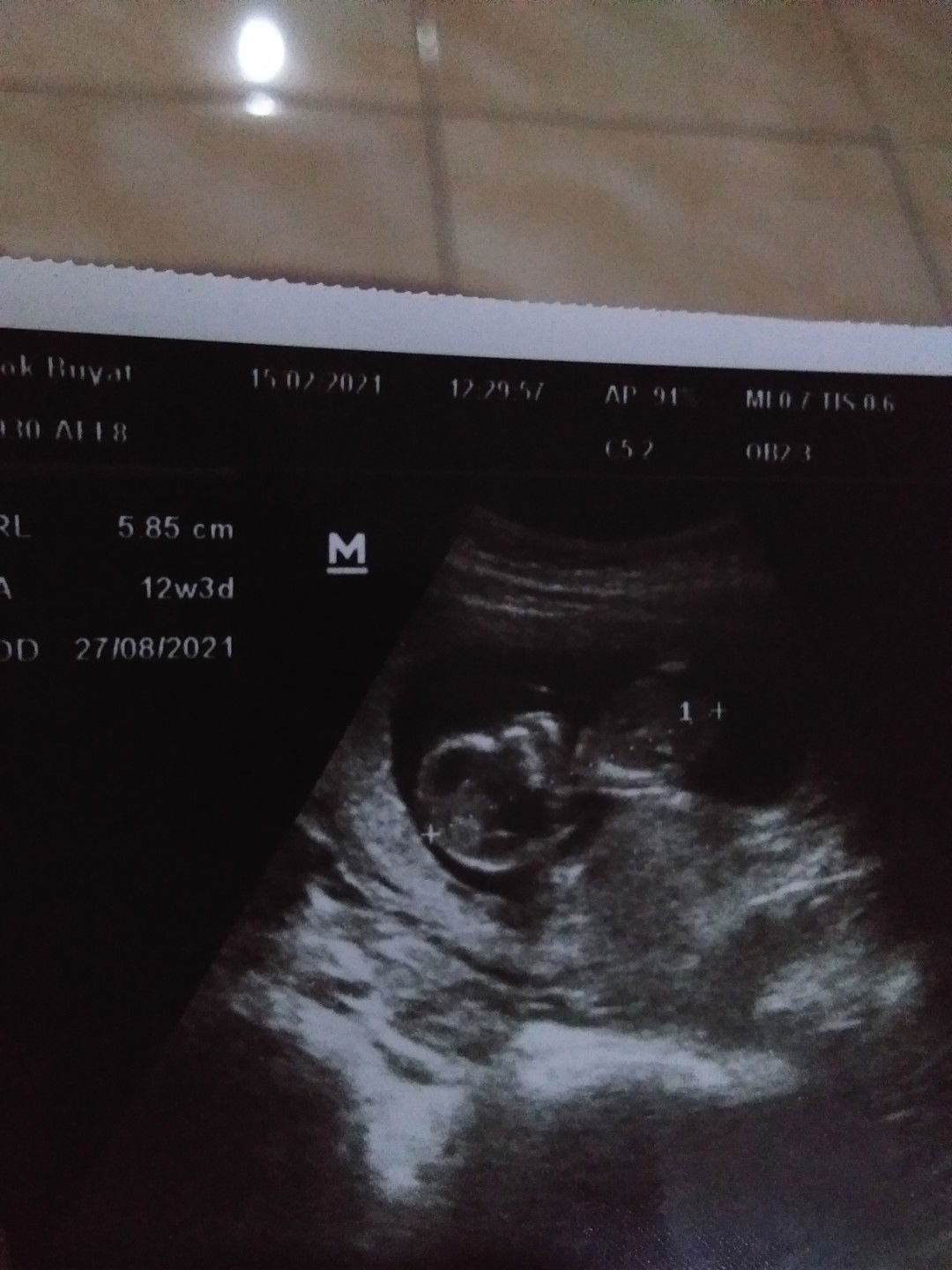 Nurmala Nurmala profile icon