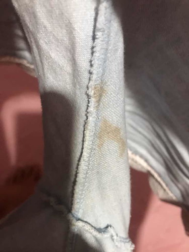 ปวดท้องทุก 10-15 นาที