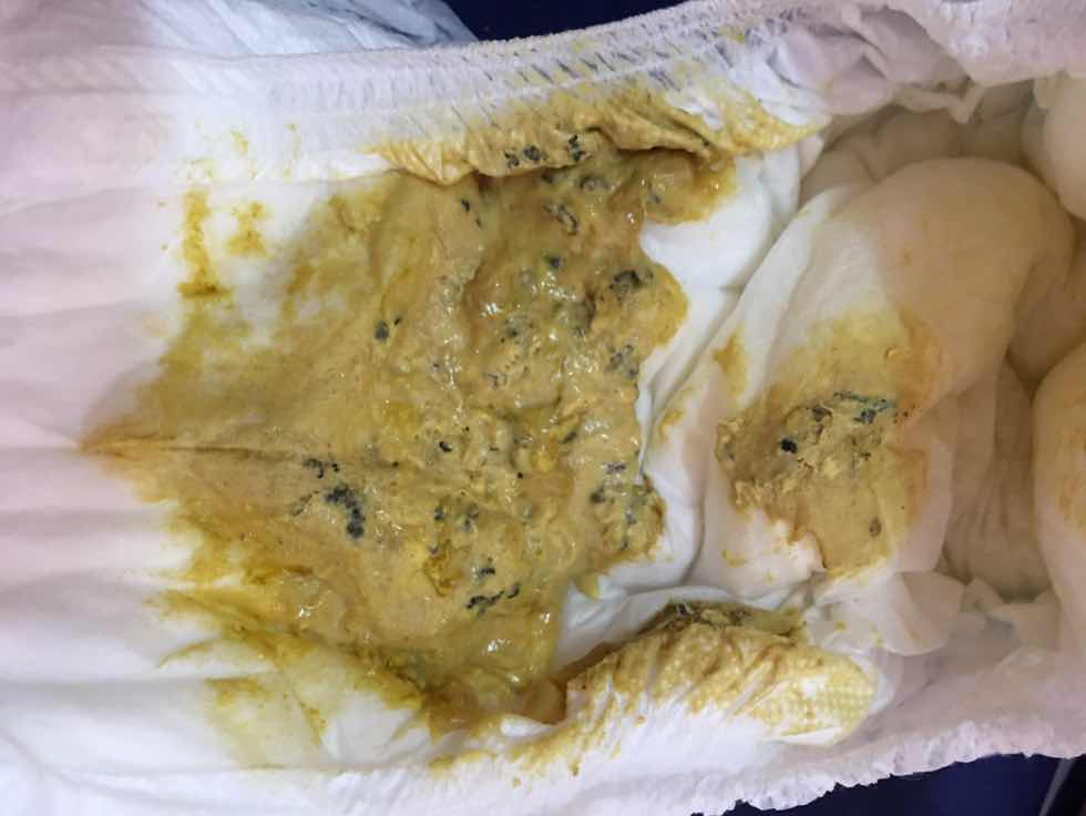 สีอุจจาระของลูก