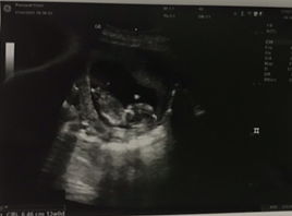 ฝ้าย ฝ้าย profile icon