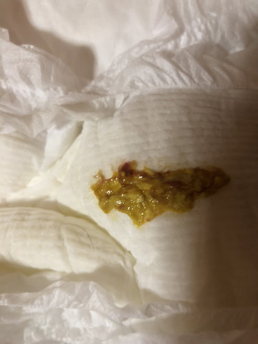 อึของลูก