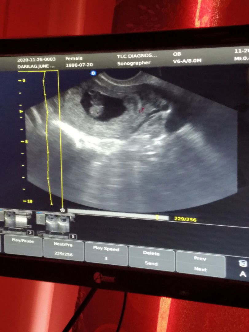 Lyka Darilag profile icon