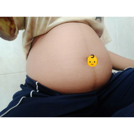 ตั้งครรภ์