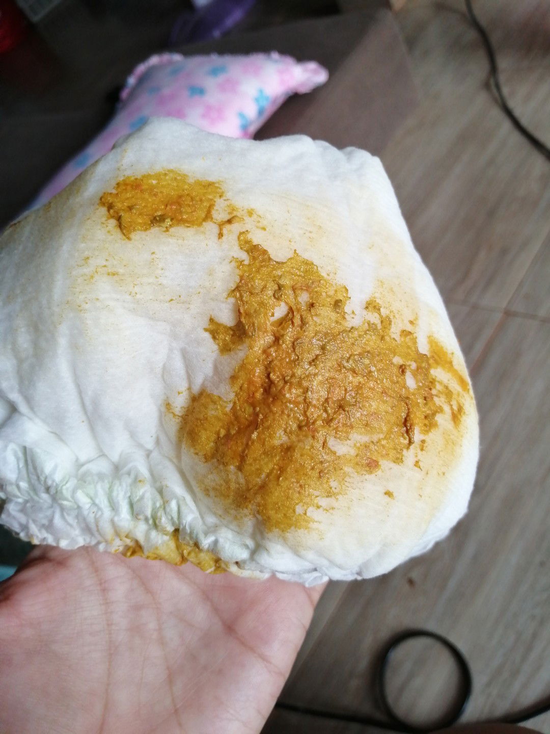 น้องท้องเสียแบบนี้