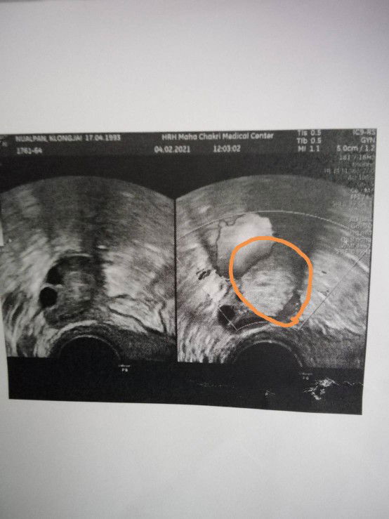 ช่วยดูหน่อยค่ะ