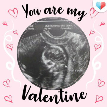 Baby Franzia profile icon