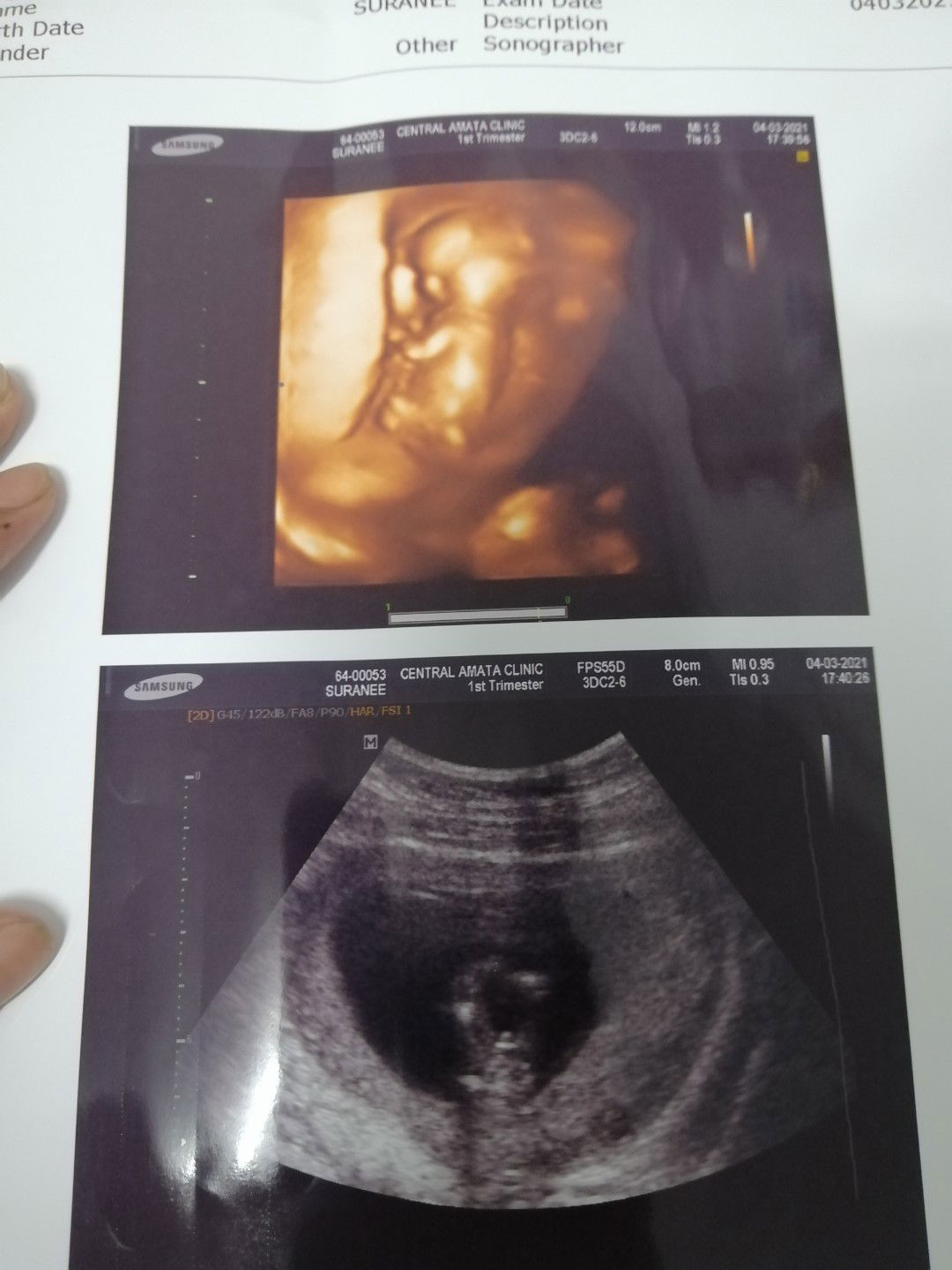 Tong Suranee profile icon