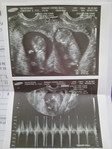 Baby Tala profile icon