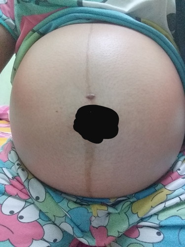 32 +2W