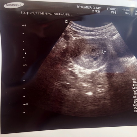 สอบถามหน่อยค่ะ