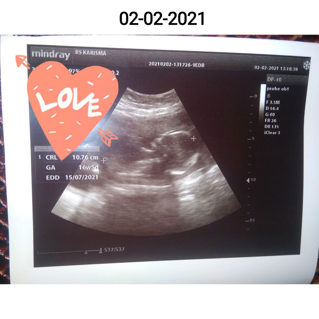 Ardiansyah Agustiyan Natta profile icon