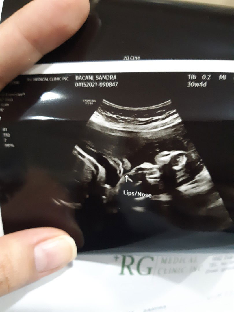 Sandra Bacani profile icon