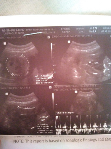 Hey! Mommies I am 23 weeks pregnant ask lang po ako kung pwede na magpahilot na transverse baby ko