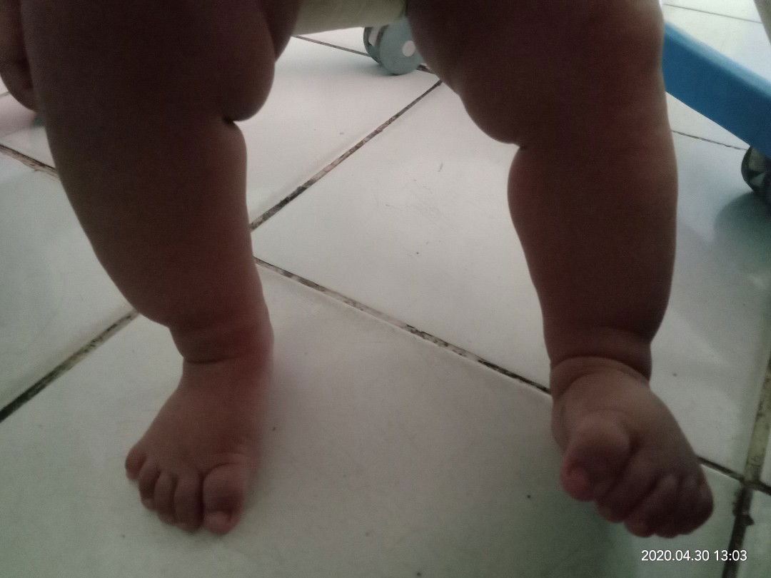 keseringan pakek kaos kaki kaki jadi kecil