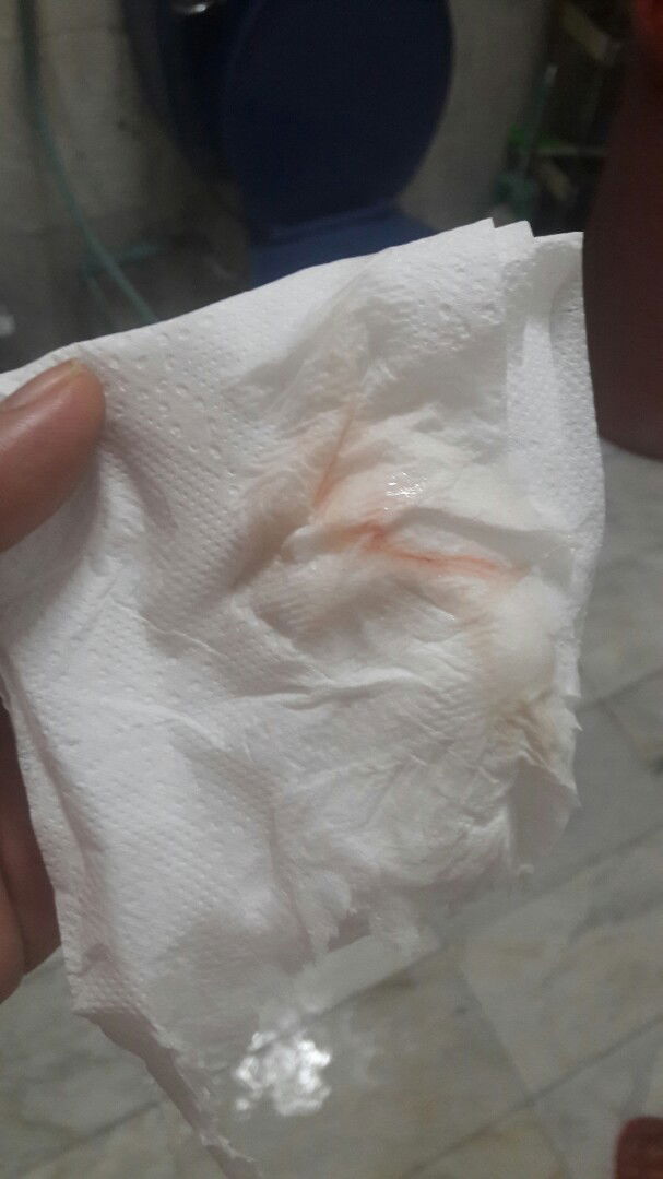 มูกเลือด