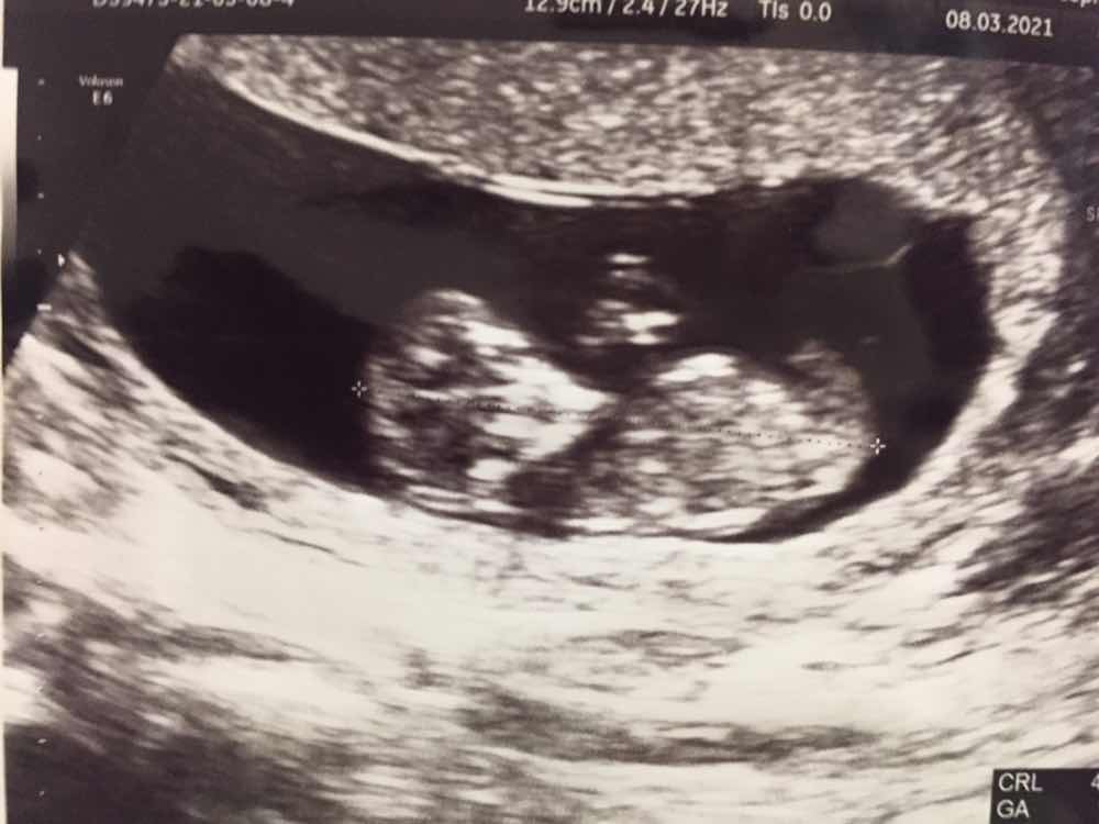 Jie Yee profile icon