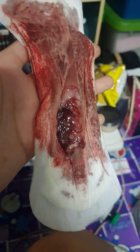 ปจด มาแบบผิดปกติ