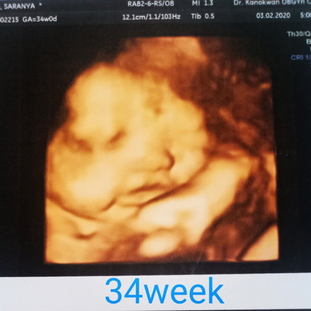 เด็กน้อยเดือนมีนาคม63