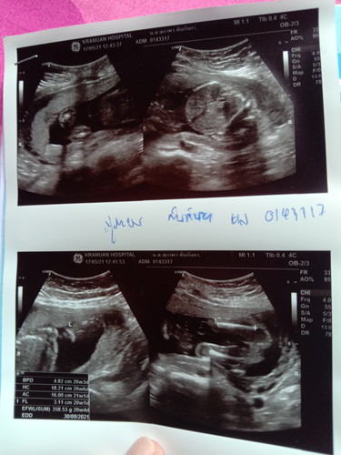 ขอเสียงแม่ๆทีมกันยาหน่อยจ้า