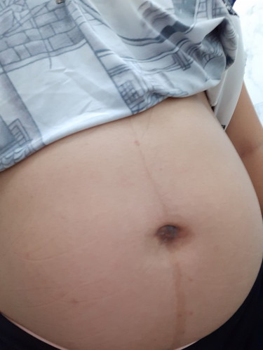 ิเพศลูก
