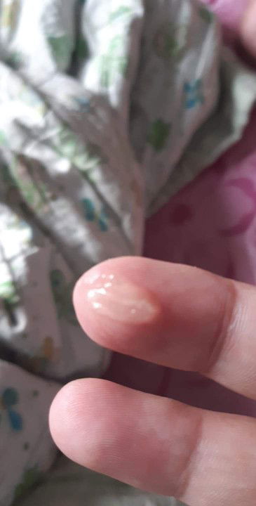 ใช่มูกไหม