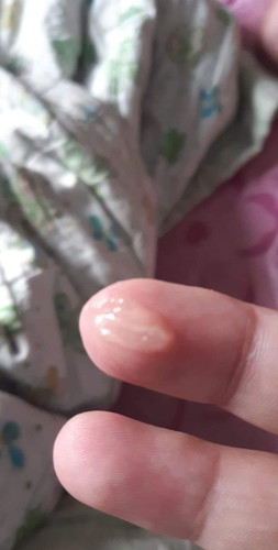 ใช่มูกไหม