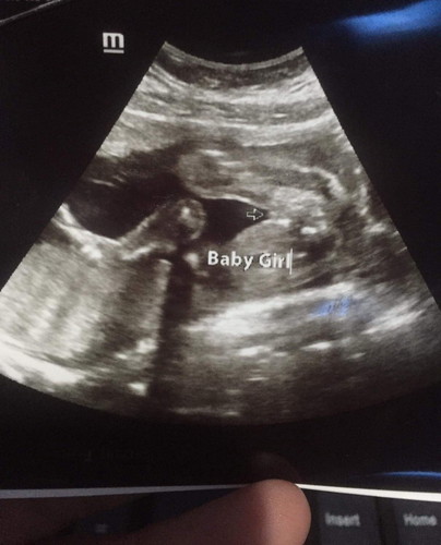 Suggest baby girl name