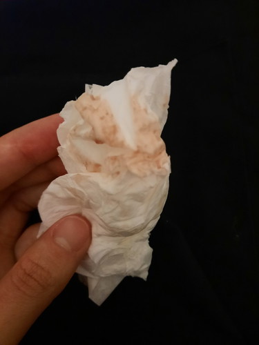 สอบถามแม่ๆหน่อยค่ะ