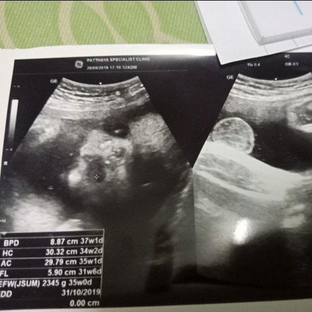 ปกติไหมจ้า พอดีดูไม่ค่อยเป็นคะ เห็นแต่หน้าลูก??