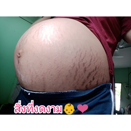 แตกแล้วก็แตก555