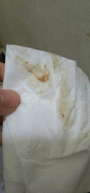 implantation bleeding po ba ito?