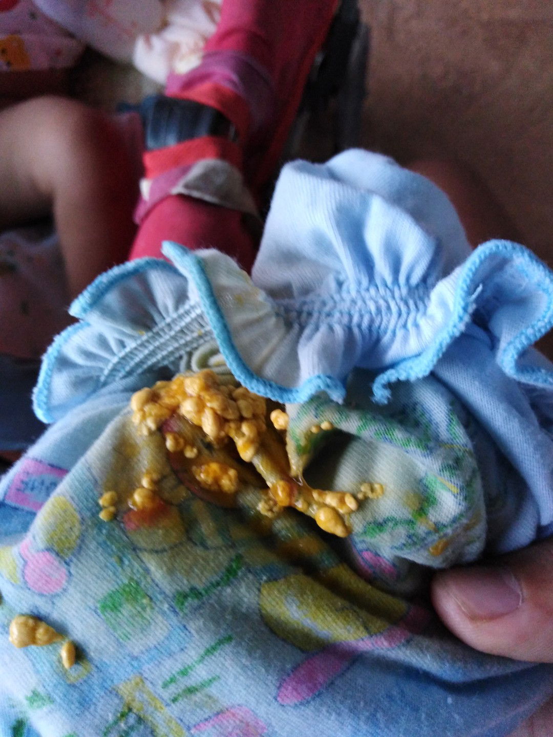 น้องถ่ายแบบนี้หลายครั้งเป้นอะรัยไหมค่ะปกติไหม